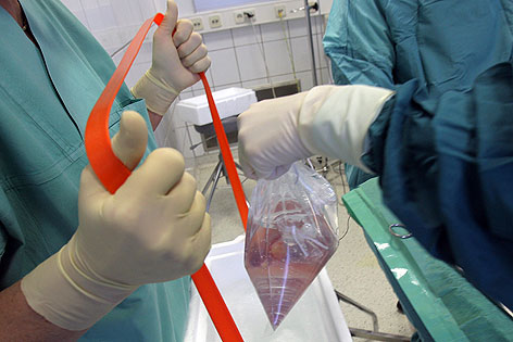 Niere vor Transplantation in Operationssaal