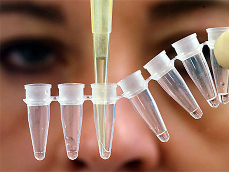Labor Untersuchung DNA