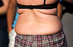 Übergewichtige Frau von hinten