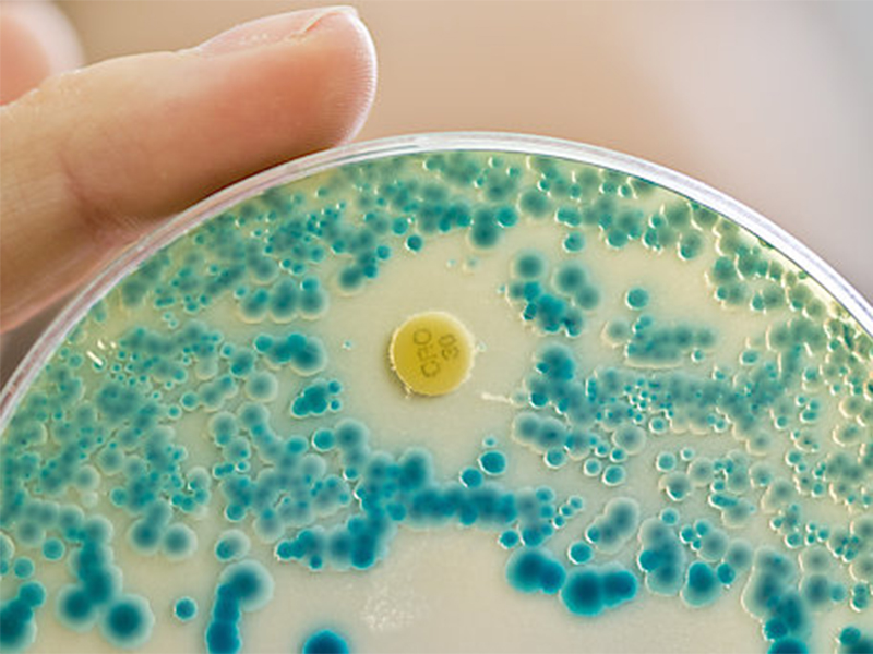 Indikator-Kulturplatte zum Nachweis von resistenten Bakterien